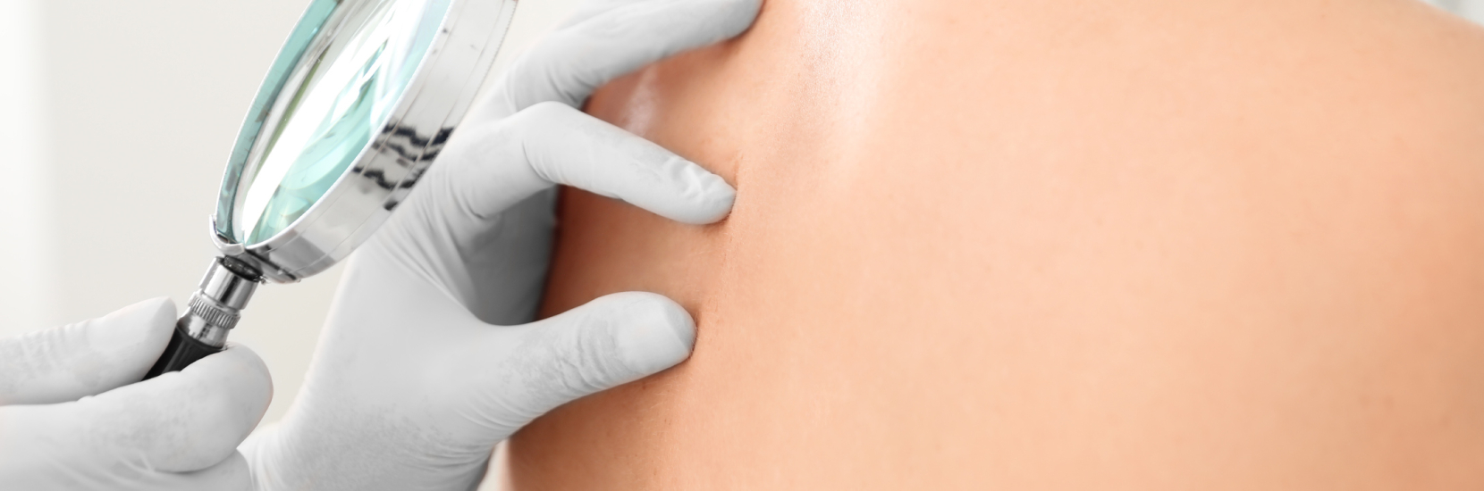 Retour à domicile suite à une biopsie cutanée (petites fibres)