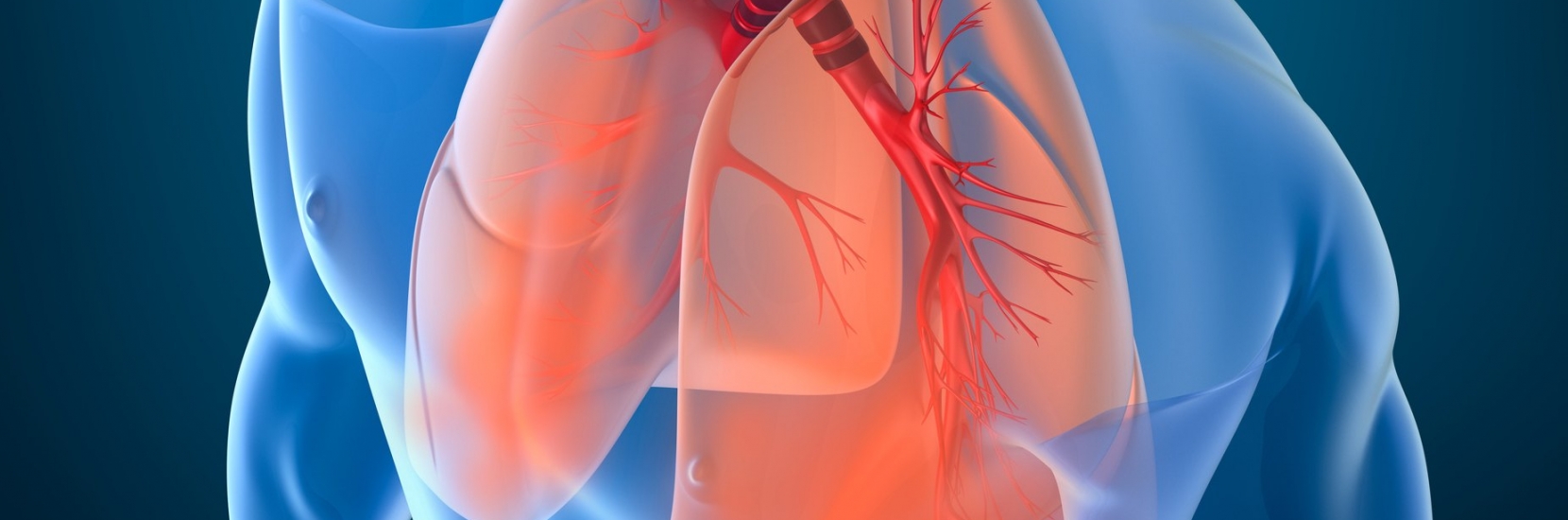 ECMO en chirurgie thoracique (Extracorporelle Membrane Oxygénation)